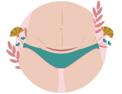 تجربتي مع بروز البطن بعد عملية الشد