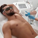 إزالة الشعر بالليزر للرجال