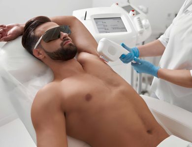 إزالة الشعر بالليزر للرجال